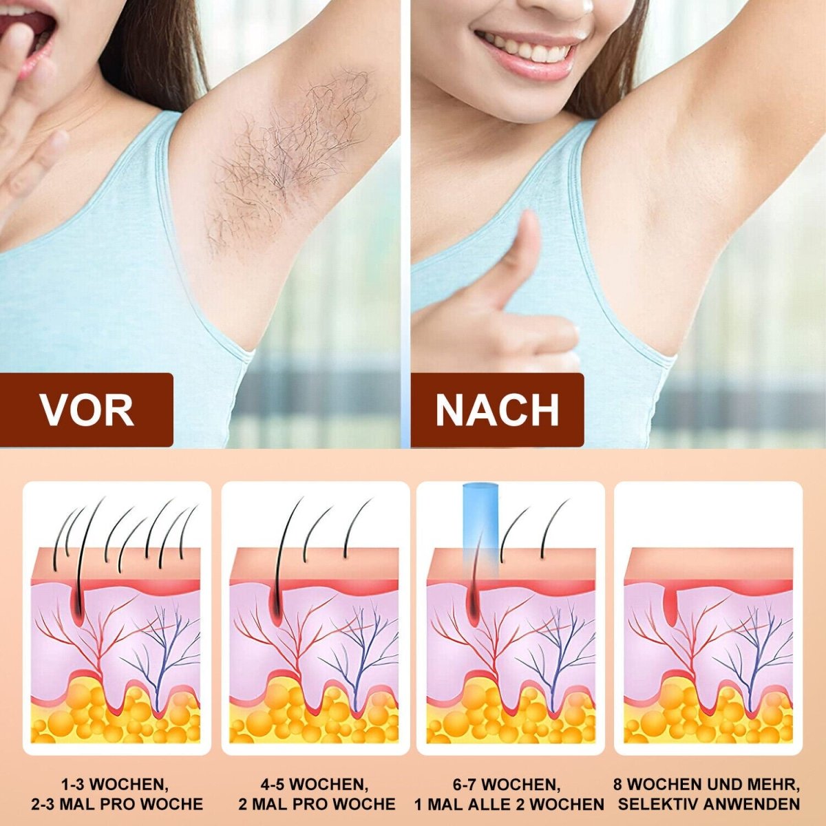DermaLuxe™️ - IPL Laser Haarentfernungs Handgerät System - Waagemann