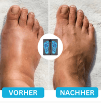 FeetRelief Nmes Nooro Fußmassagegerät Wowhealth Fußmassager bei Neuropathie - Waagemann