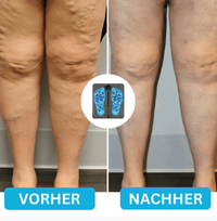 FeetRelief Nmes Nooro Fußmassagegerät Wowhealth Fußmassager bei Neuropathie - Waagemann