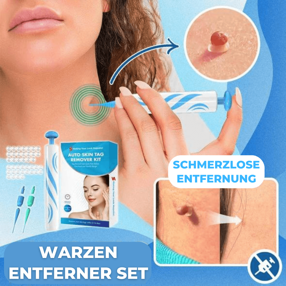 Warzen & Stielwarzen Entferner Set - Waagemann